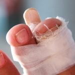 Clasificación y tratamiento de fracturas abiertas
